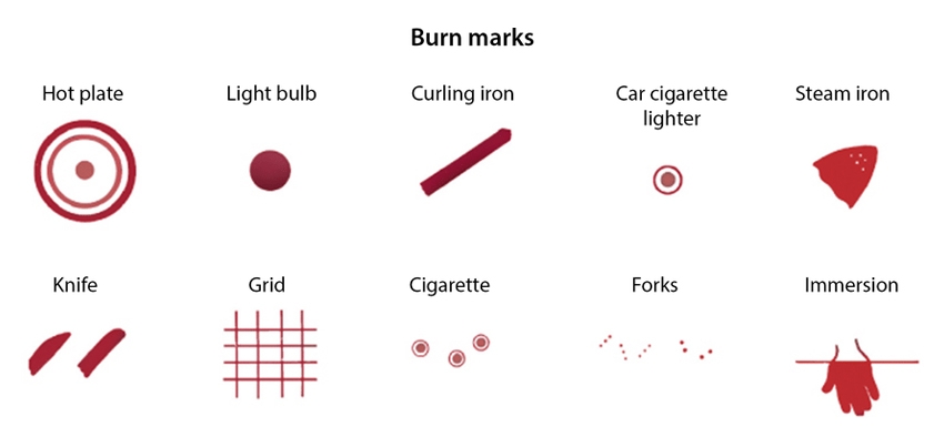 Indicators of Abusive Burns
