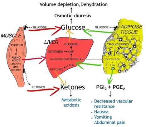 Pediatric Diabetic Ketoacidosis