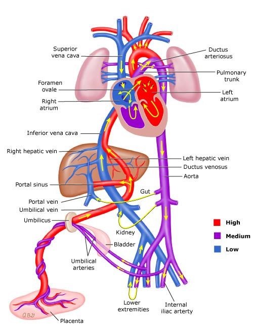 Persistent Pulmonary Hypertension of the Neonate (PPHN)