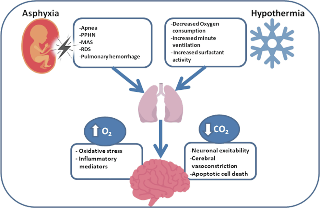 Hypoxic Ischemic Encephalopathy