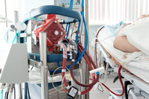 Extracorporeal Membrane Oxygenation